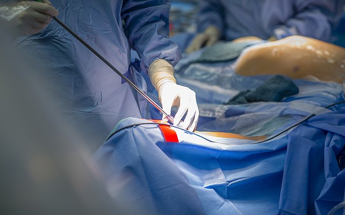 Sektion Innovative interventionelle Herzmedizin