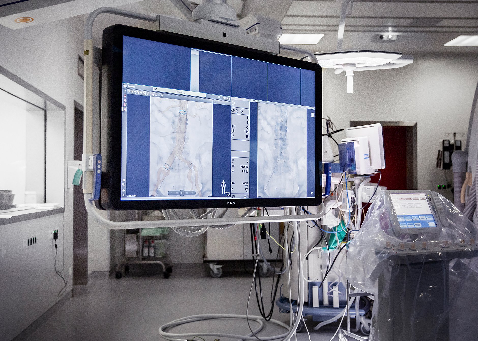 HGZ | Hybrid-OP Dies ist ein Bildschirm im Hybrid-OP-Saal des HGZ Bad Bevensen.