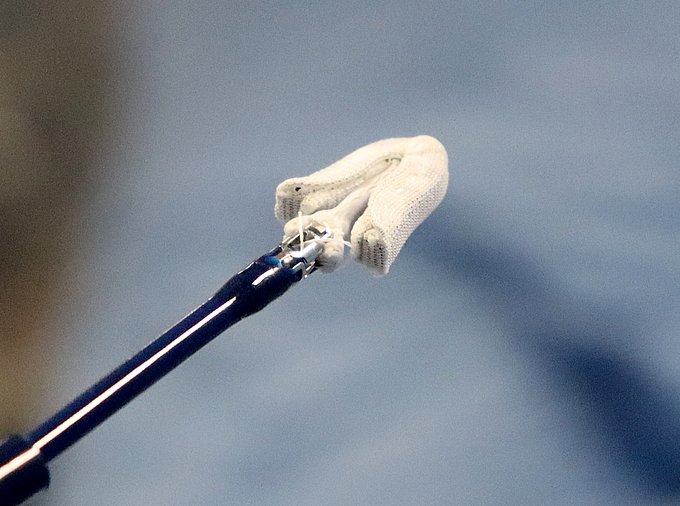 Clip-Verfahren und Cardioband